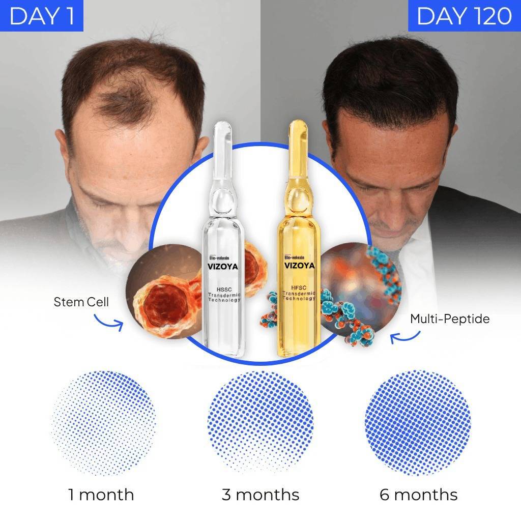 Peptide & Stem Cell Hair Growth System